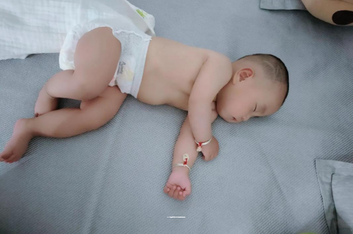 昌邑宝宝头上长痱子